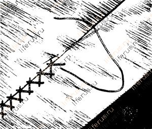 Бархатный шов, или «козлик»