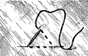 Шов «треугольник»