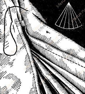 Обработка веерообразных складок